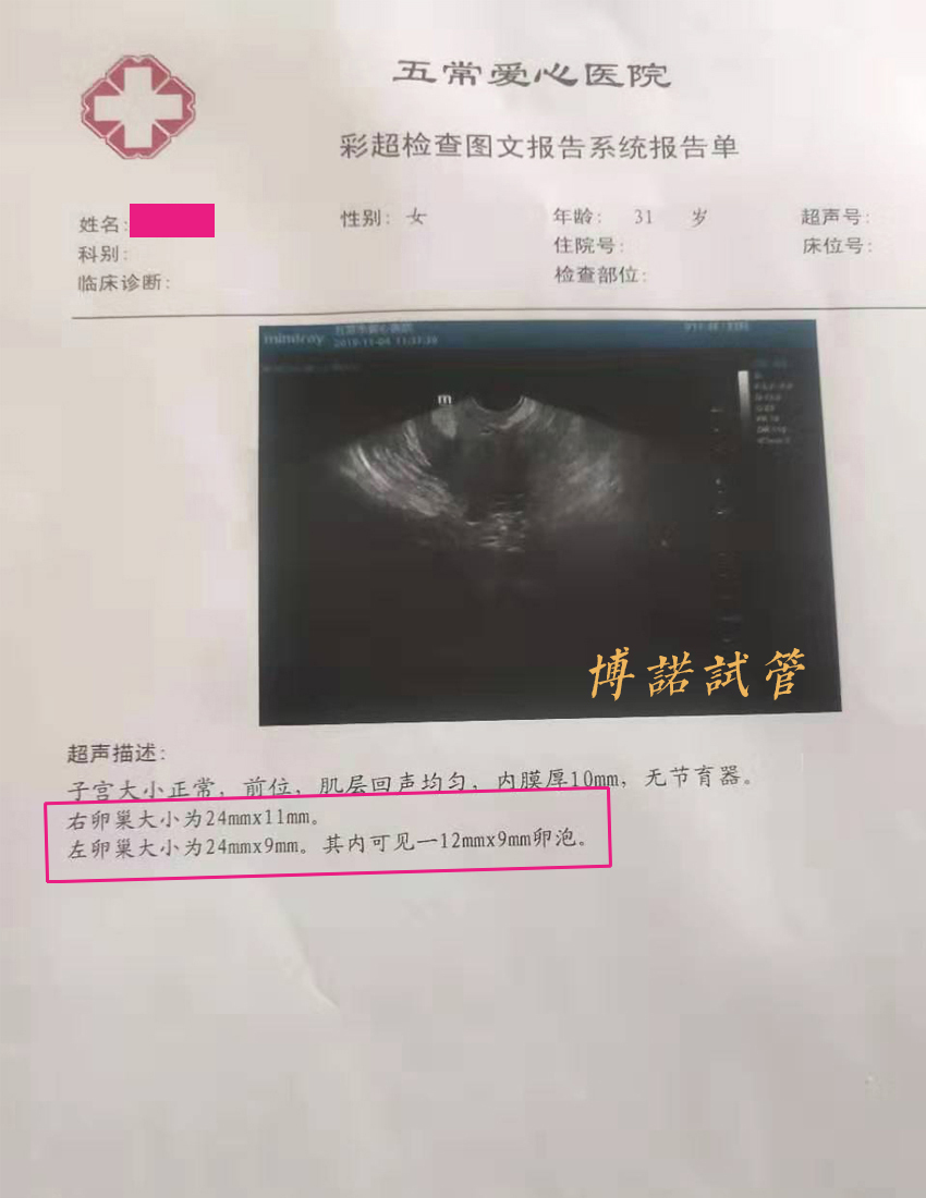 美国代孕流程.jpg