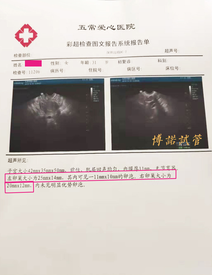 美国代孕妈妈.jpg