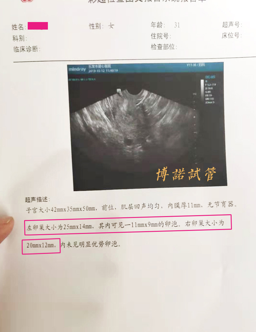 美国代孕中介.jpg