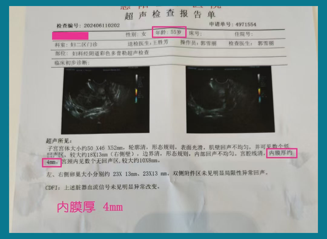 借卵试管.jpg